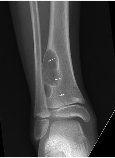 PHCN gay xuong_page42_image10