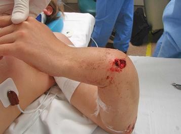 PHCN gay xuong_page42_image16