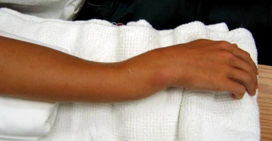 PHCN gay xuong_page42_image17