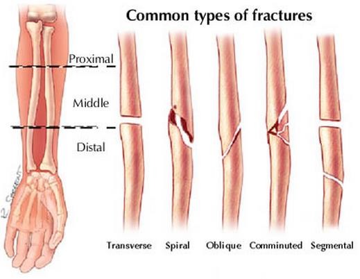 PHCN gay xuong_page42_image22