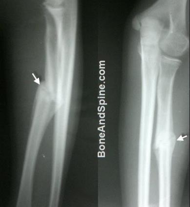 PHCN gay xuong_page42_image36