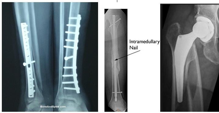 PHCN gay xuong_page42_image45