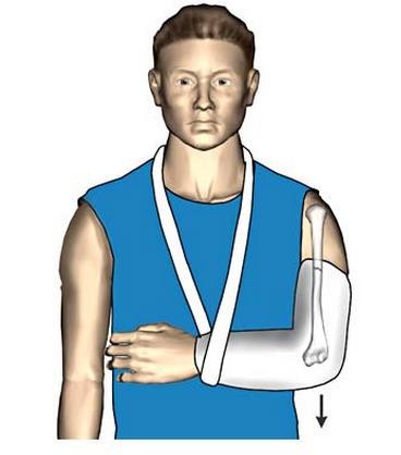 PHCN gay xuong_page42_image53