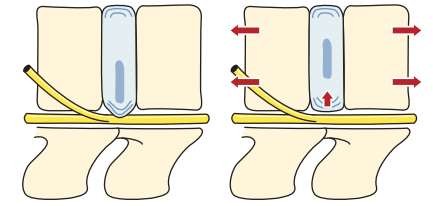 Traction_page8_image2