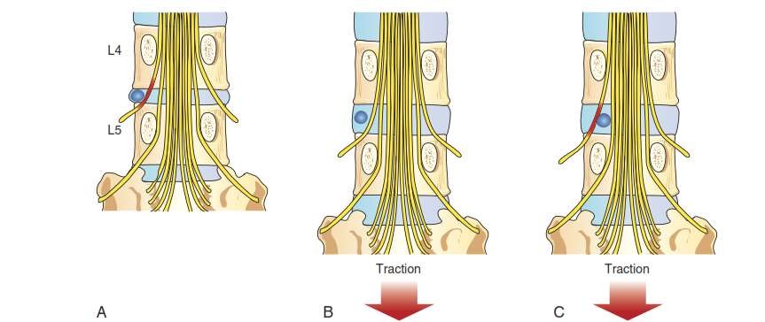 Traction_page8_image3