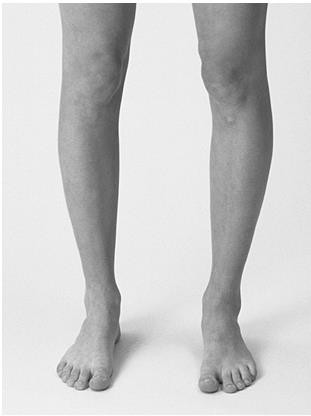 gpcn chi duoi_page87_image19