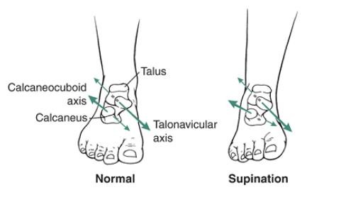 The Ankle and Foot_page13_image14
