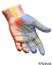 median nerve