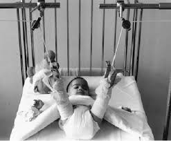 Hình ảnh này chưa có thuộc tính alt; tên tệp của nó là traction-2.jpeg