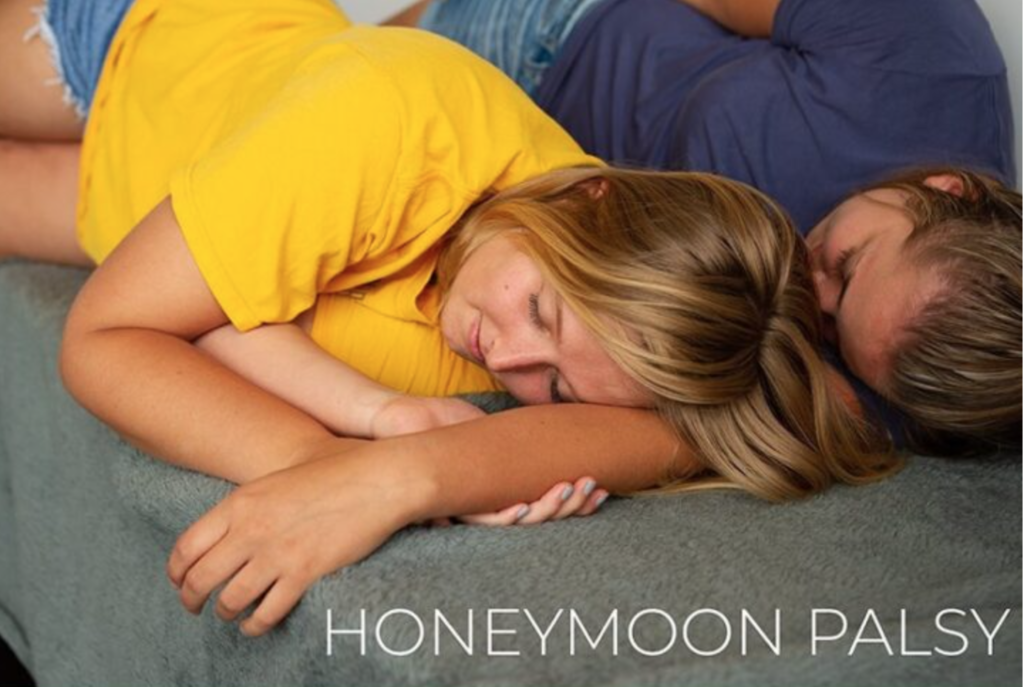 CASE REPORT N 03: GÃY XƯƠNG BỆNH LÝ VÀ TỔN THƯƠNG DÂY THẦN KINH QUAY