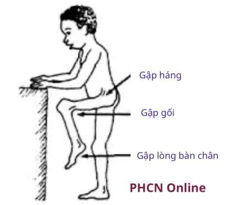 Các vị trí bị co rút