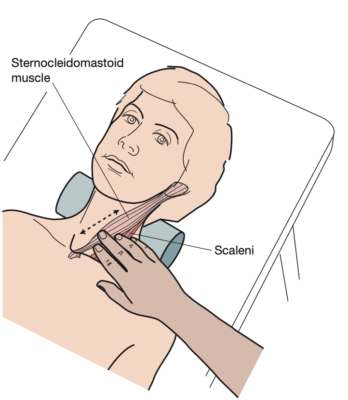 sờ cơ bậc thang