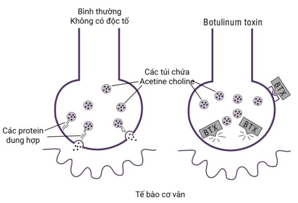 Botulinum toxin 
