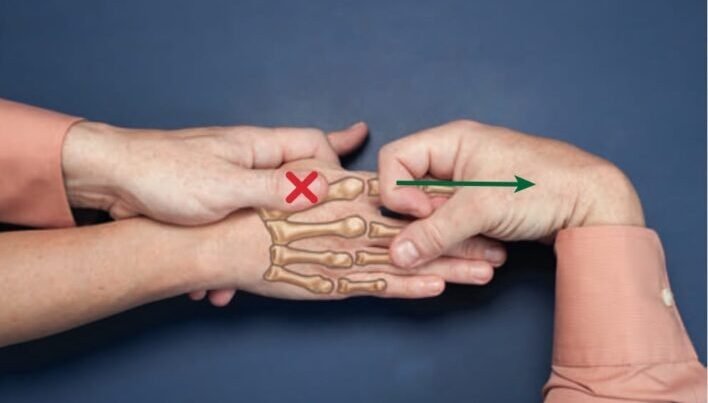 JOINT MOBILIZATION OF THE WRIST AND THE HAND. PART 2 - PHCN Online