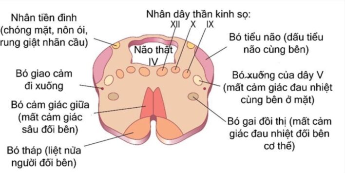 Sơ đồ cắt ngang hành não