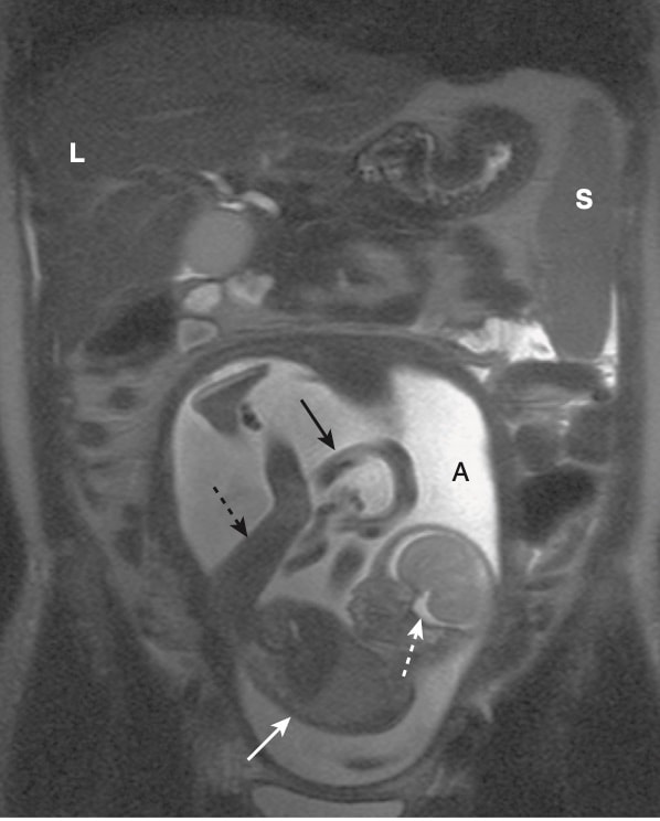 Hình 12 Đại cương MRI