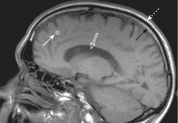 Hình 5 Đại cương MRI