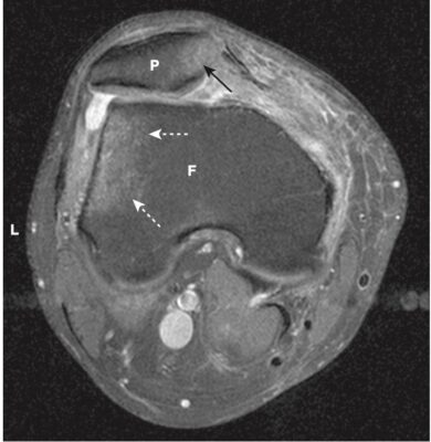 Hình 7 Đại cương MRI