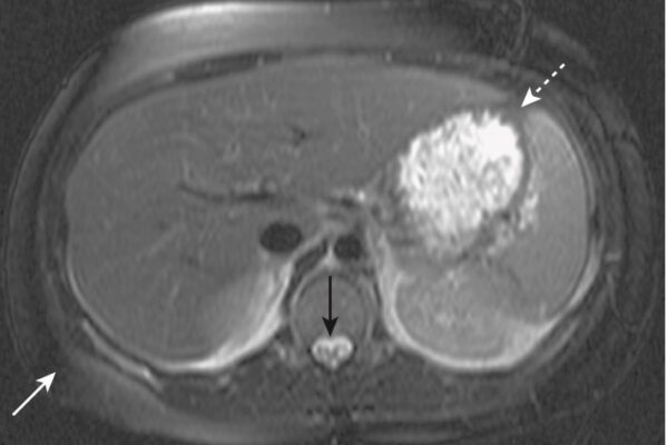 Hình 8 Đại cương MRI