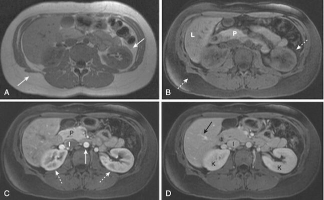Hình 10 Đại cương MRI