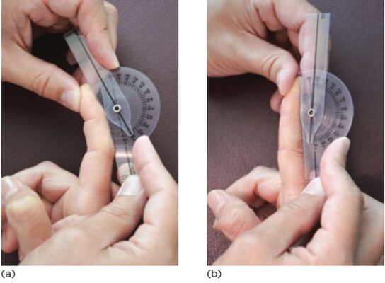 ROM gấp duỗi DIP các ngón