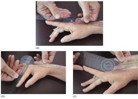 ROM gấp - duỗi MCP các ngón 