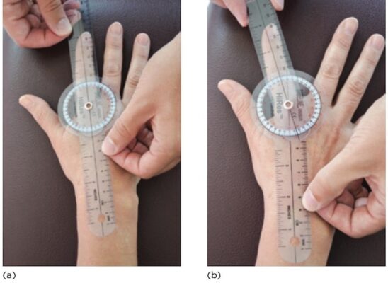 ROM dạng MCP ngón trỏ