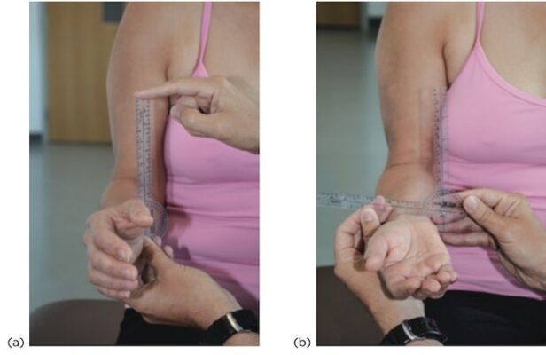 ROM ngửa cẳng tay