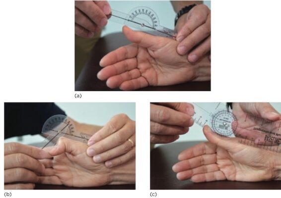 ROM gấp duỗi IP ngón cái