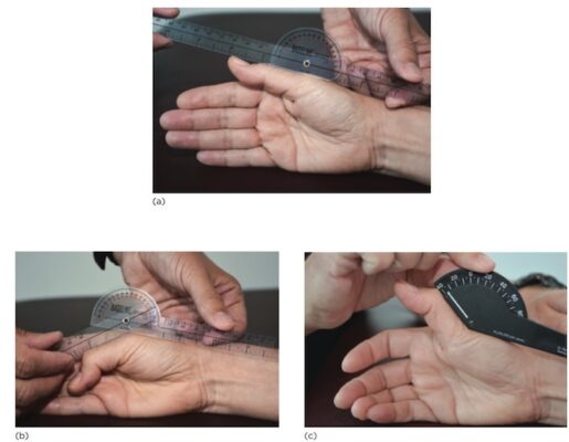 ROM gấp - duỗi MCP ngón cái