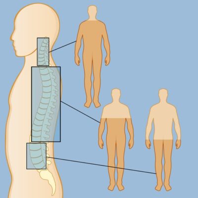 Hi vọng mới dành cho người liệt: Một mũi tiêm vào tủy sống giúp phục hồi khả năng vận động sau 4 tuần - Ảnh 1.