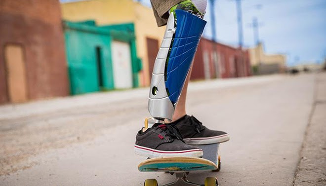 Paralympic: Sân chơi ươm mầm cho những công nghệ đột phá - Ảnh 2.