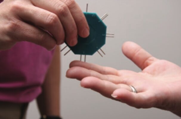 Hình 15 khám phân biệt 2 điểm