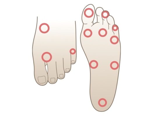 Hình 6. Các vùng thường được khám ở bàn chân