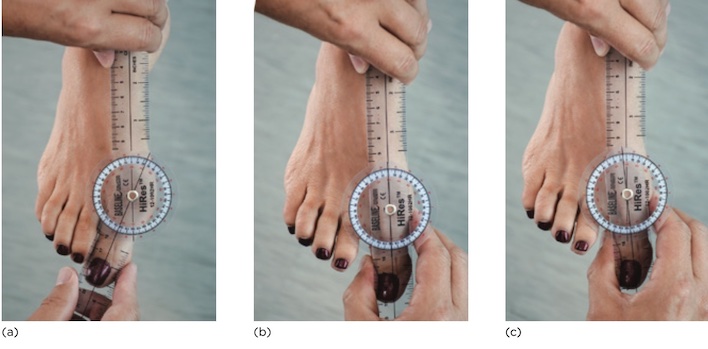 ROM dạng khép khớp MTP thứ nhất