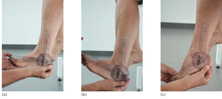 ROM gấp mu (b) và gấp lòng (c)