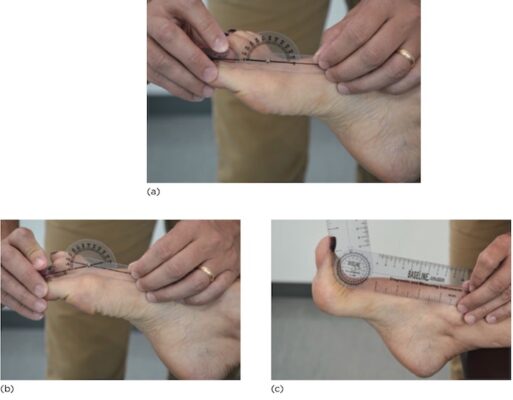 ROM gập (b) và duỗi (c) khớp MTP thứ nhất