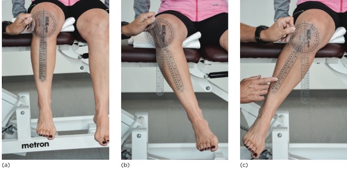 ROM xoay ngoài (b) và xoay trong (c) khớp háng