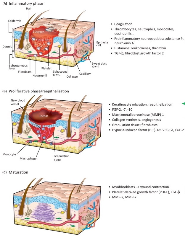 Hình: 3 giai đoạn của lành vết thương