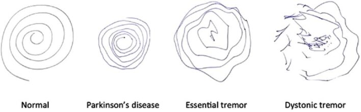 An external file that holds a picture, illustration, etc.
Object name is AIAN-19-433-g007.jpg