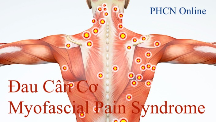 4. Chẩn đoán và phân loại mã ICD cho Migraine