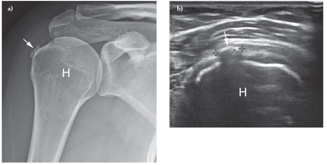 Click on image to zoom