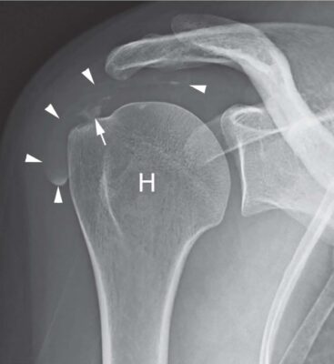 An external file that holds a picture, illustration, etc.
Object name is ACTA-89-186-g002.jpg