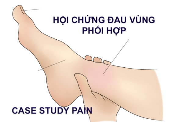 CASE STUDY PAIN N18: HỘI CHỨNG ĐAU VÙNG PHỐI HỢP