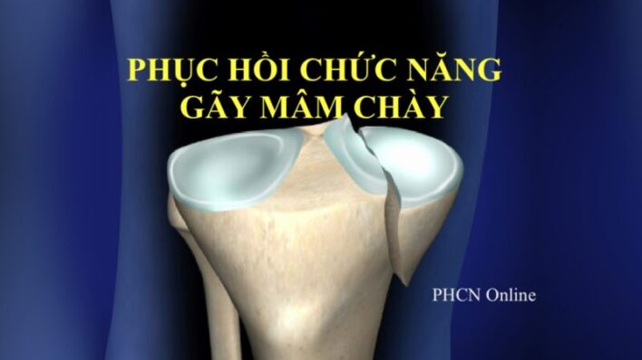 GÃY MÂM CHÀY: TỔNG QUAN VÀ PHỤC HỒI CHỨC NĂNG