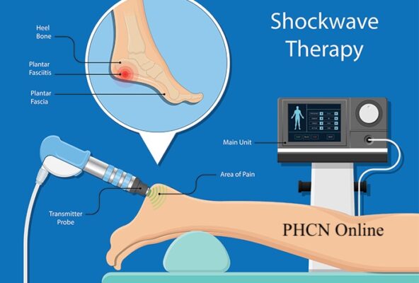 SÓNG XUNG KÍCH TRỊ LIỆU