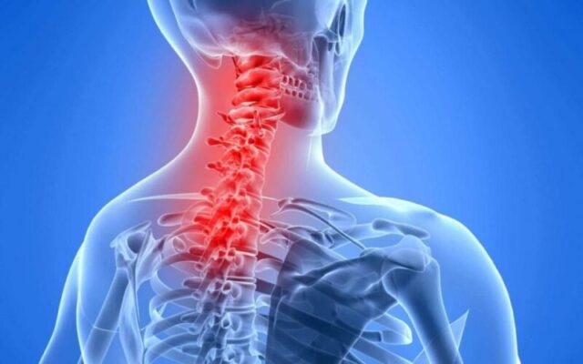 TIẾP CẬN BỆNH NHÂN ĐAU VÙNG CỔ